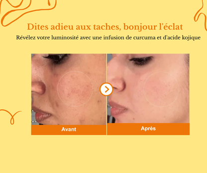 Kojic-Derm - Crème unifiante anti-hyperpigmentation