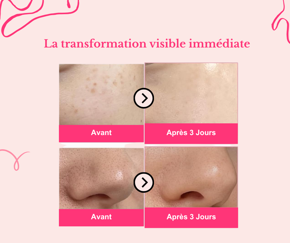 PDRN Pink Derm - Sérum régénérant & éclat