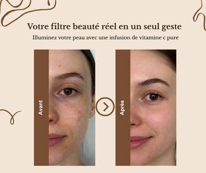 VitaC Derm - Crème anti-taches & éclat