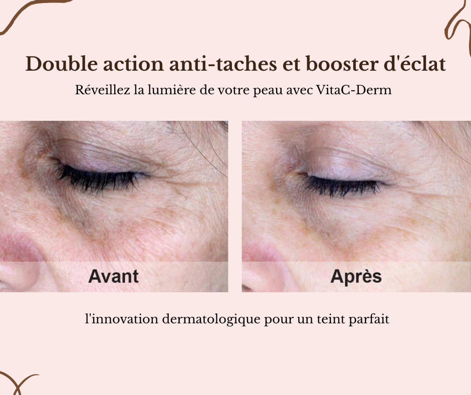 VitaC Derm - Crème anti-taches & éclat
