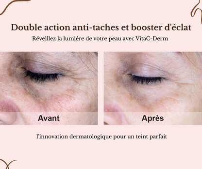 VitaC Derm - Crème anti-taches & éclat